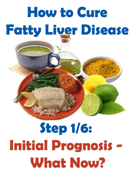 diagnosed with fatty liver disease